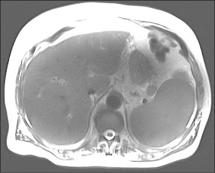 https://cdn.ncbi.nlm.nih.gov/pmc/blobs/0f80/5496584/6893b82c3c1d/CG-CGCR170052F001.jpg