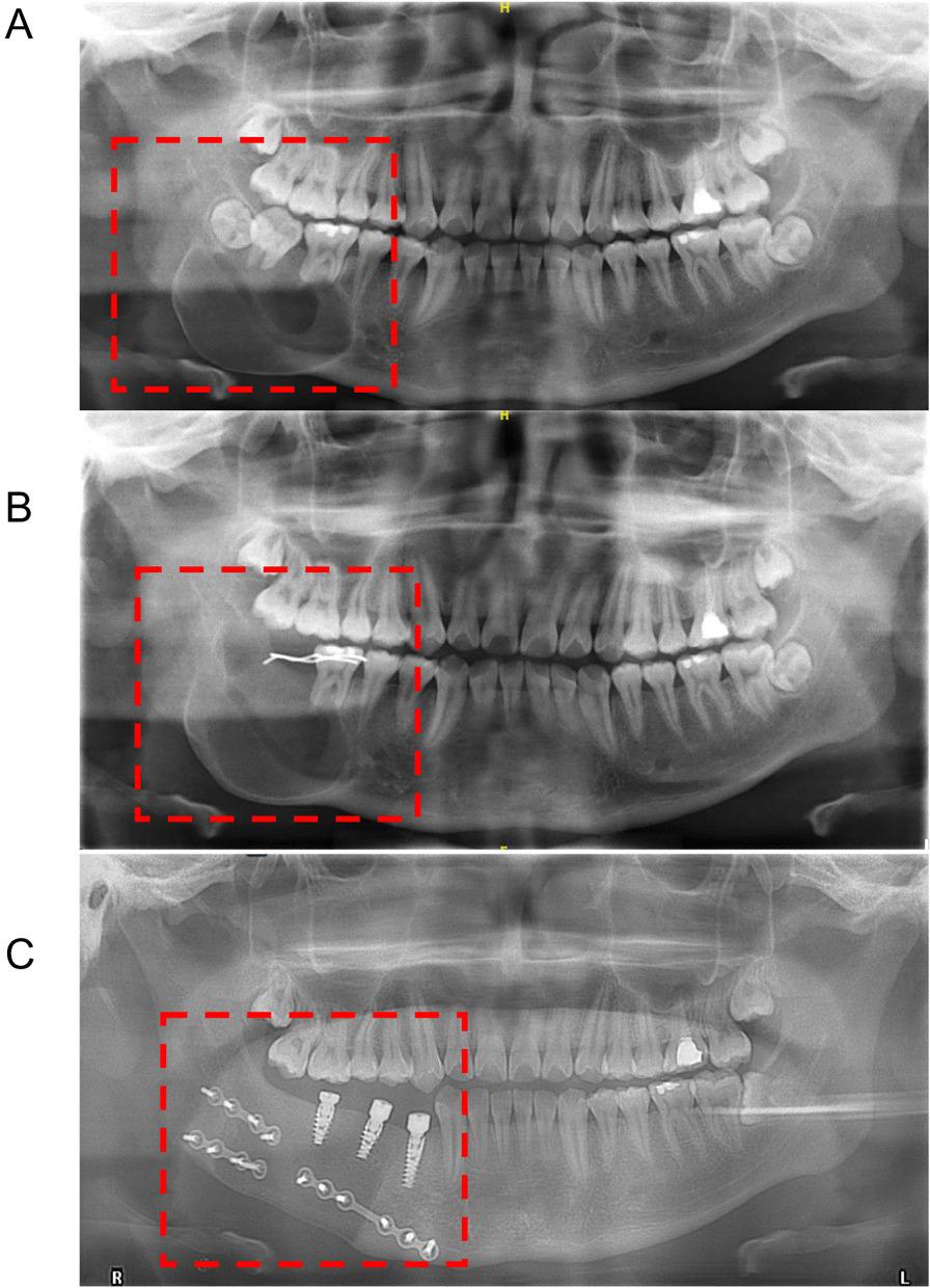 https://cdn.ncbi.nlm.nih.gov/pmc/blobs/0f86/9563122/b1ed15a1d4b6/12903_2022_2474_Fig4_HTML.jpg