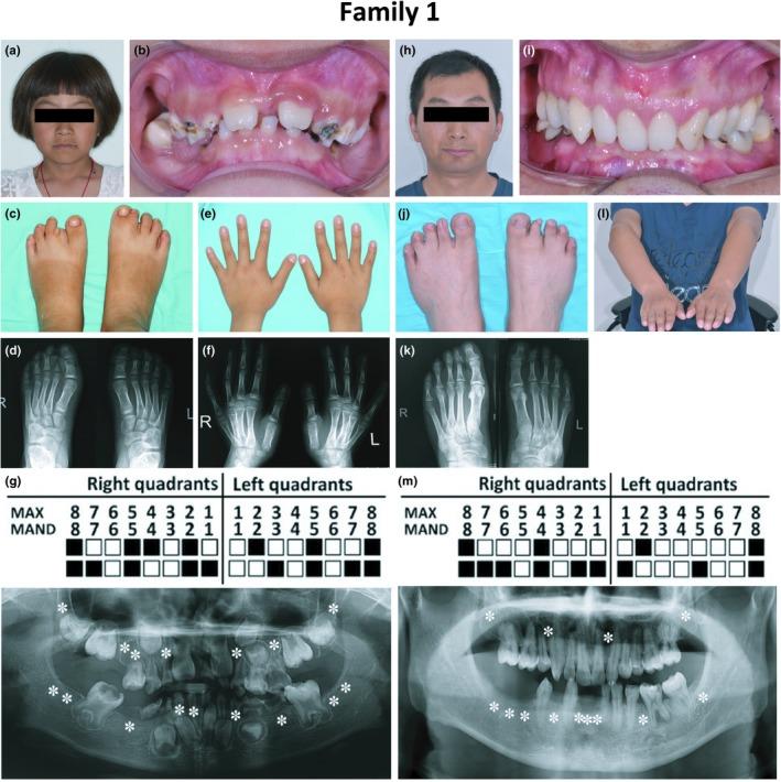 https://cdn.ncbi.nlm.nih.gov/pmc/blobs/0f8c/6565570/7306ed5c94f4/MGG3-7-e704-g001.jpg