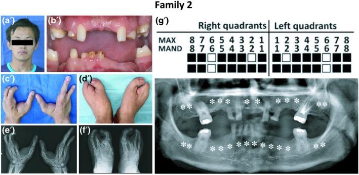 https://cdn.ncbi.nlm.nih.gov/pmc/blobs/0f8c/6565570/cc64af59c3cf/MGG3-7-e704-g002.jpg