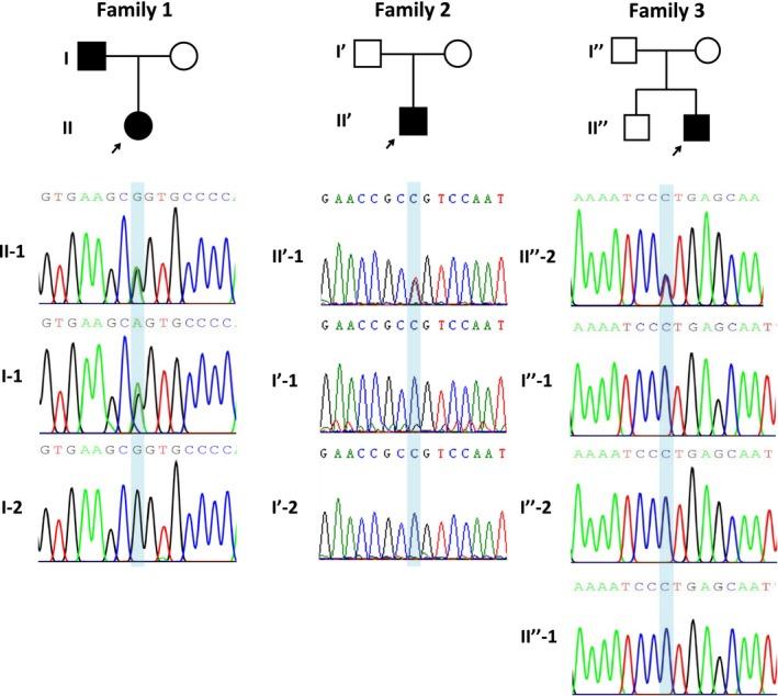 https://cdn.ncbi.nlm.nih.gov/pmc/blobs/0f8c/6565570/e190fadb7bc8/MGG3-7-e704-g004.jpg