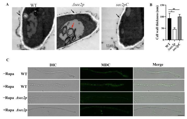 https://cdn.ncbi.nlm.nih.gov/pmc/blobs/0f8d/11767236/2a03c9e42b7e/jof-11-00036-g005.jpg