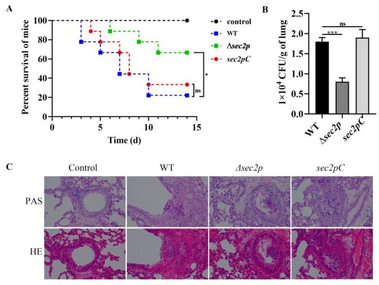 https://cdn.ncbi.nlm.nih.gov/pmc/blobs/0f8d/11767236/a138a1f8c255/jof-11-00036-g004.jpg