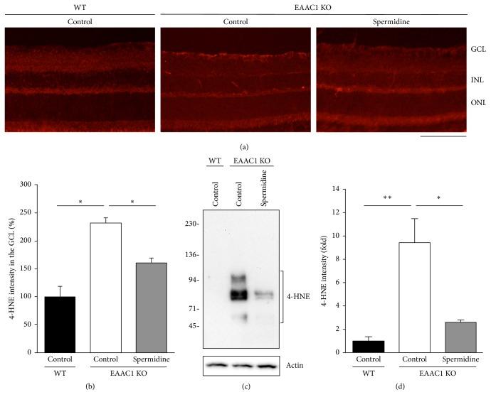 https://cdn.ncbi.nlm.nih.gov/pmc/blobs/0f8f/5320364/fb94428c4ffd/OMCL2017-2817252.001.jpg