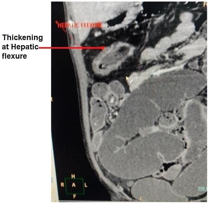 https://cdn.ncbi.nlm.nih.gov/pmc/blobs/0f9a/5423344/13f2c8c7d72b/gr2.jpg