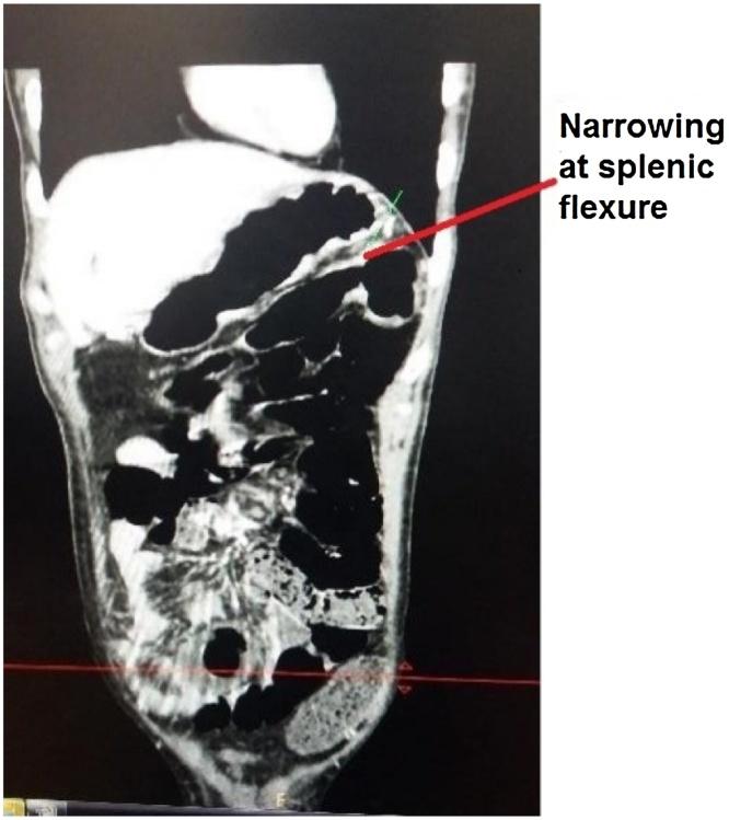 https://cdn.ncbi.nlm.nih.gov/pmc/blobs/0f9a/5423344/95ea7c7fa03f/gr3.jpg