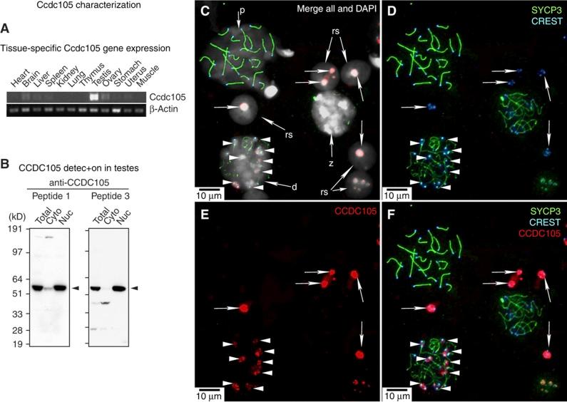 https://cdn.ncbi.nlm.nih.gov/pmc/blobs/0fa0/3817400/e5f9c707fece/msb201350-f8.jpg