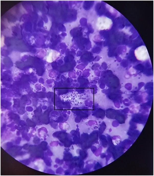 https://cdn.ncbi.nlm.nih.gov/pmc/blobs/0fa3/12123336/e22082d2ec6d/gr1.jpg
