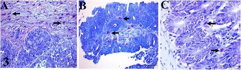 https://cdn.ncbi.nlm.nih.gov/pmc/blobs/0fa4/5397705/229c48dec3cc/12917_2017_1030_Fig3_HTML.jpg