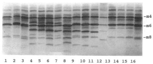 https://cdn.ncbi.nlm.nih.gov/pmc/blobs/0faa/1918455/ebdad818ffbc/ajhg00045-0047-a.jpg
