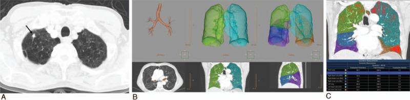 https://cdn.ncbi.nlm.nih.gov/pmc/blobs/0fad/5268002/496cdac6bae1/md-95-e5494-g002.jpg