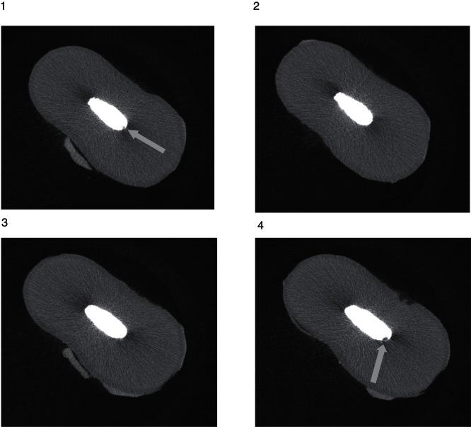 https://cdn.ncbi.nlm.nih.gov/pmc/blobs/0fb4/3667639/f9c643cb82bc/ODE-71-689-g003.jpg