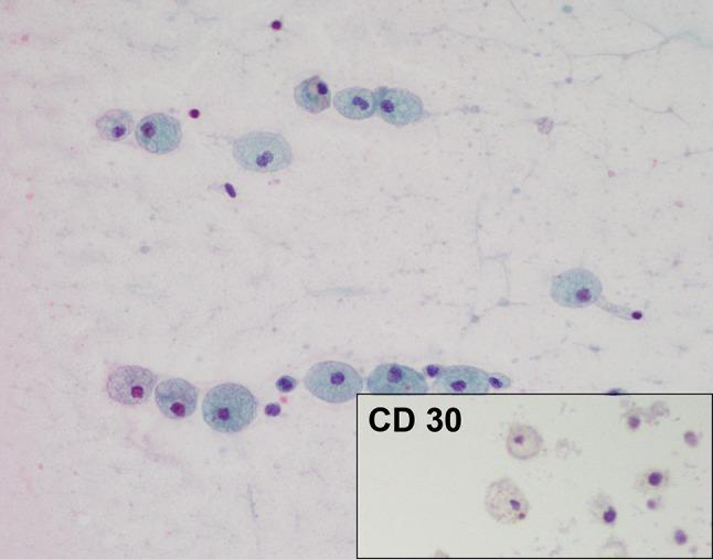 https://cdn.ncbi.nlm.nih.gov/pmc/blobs/0fb5/5945759/261667df073c/266_2017_1064_Fig8_HTML.jpg