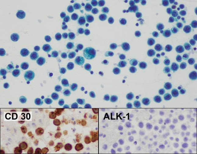https://cdn.ncbi.nlm.nih.gov/pmc/blobs/0fb5/5945759/3ddcc4162f22/266_2017_1064_Fig7_HTML.jpg