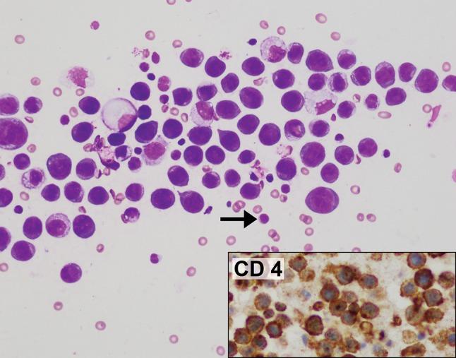 https://cdn.ncbi.nlm.nih.gov/pmc/blobs/0fb5/5945759/4fe538409f3c/266_2017_1064_Fig6_HTML.jpg