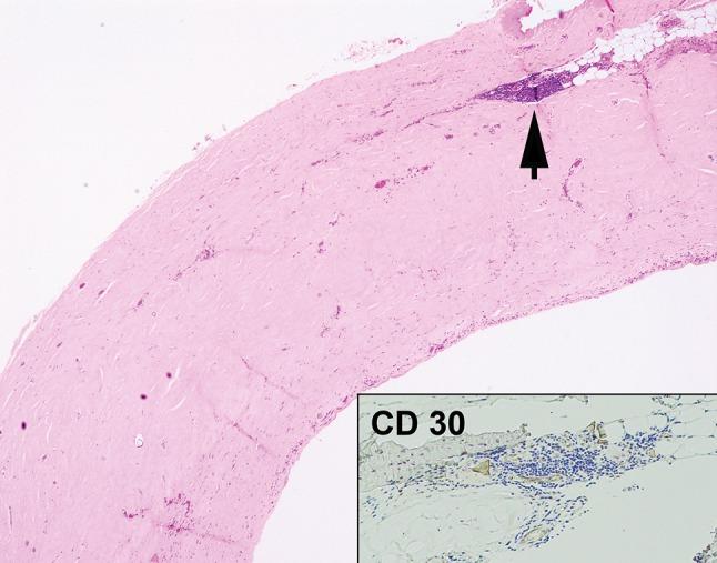 https://cdn.ncbi.nlm.nih.gov/pmc/blobs/0fb5/5945759/764258567ae2/266_2017_1064_Fig5_HTML.jpg