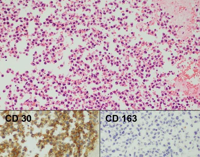 https://cdn.ncbi.nlm.nih.gov/pmc/blobs/0fb5/5945759/9318d9c08029/266_2017_1064_Fig2_HTML.jpg