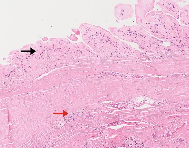 https://cdn.ncbi.nlm.nih.gov/pmc/blobs/0fb5/5945759/9d7661ed2f65/266_2017_1064_Fig9_HTML.jpg