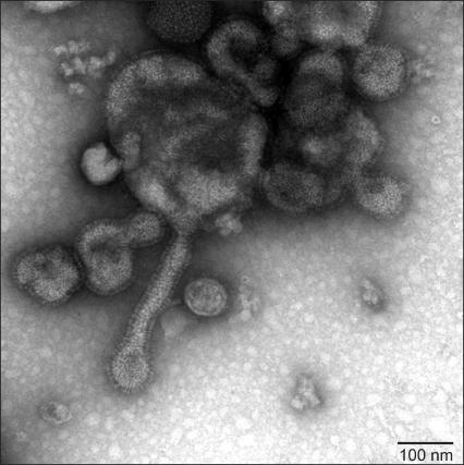 https://cdn.ncbi.nlm.nih.gov/pmc/blobs/0fb6/2833431/cfe41c82590c/jvs-11-59-g002.jpg