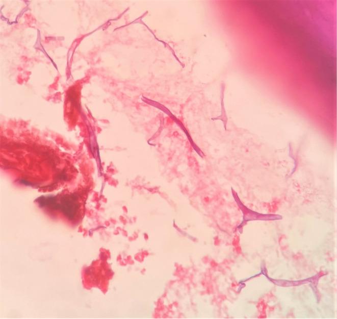 https://cdn.ncbi.nlm.nih.gov/pmc/blobs/0fb9/10160432/b9a9aef8901a/CCR3-11-e7292-g008.jpg