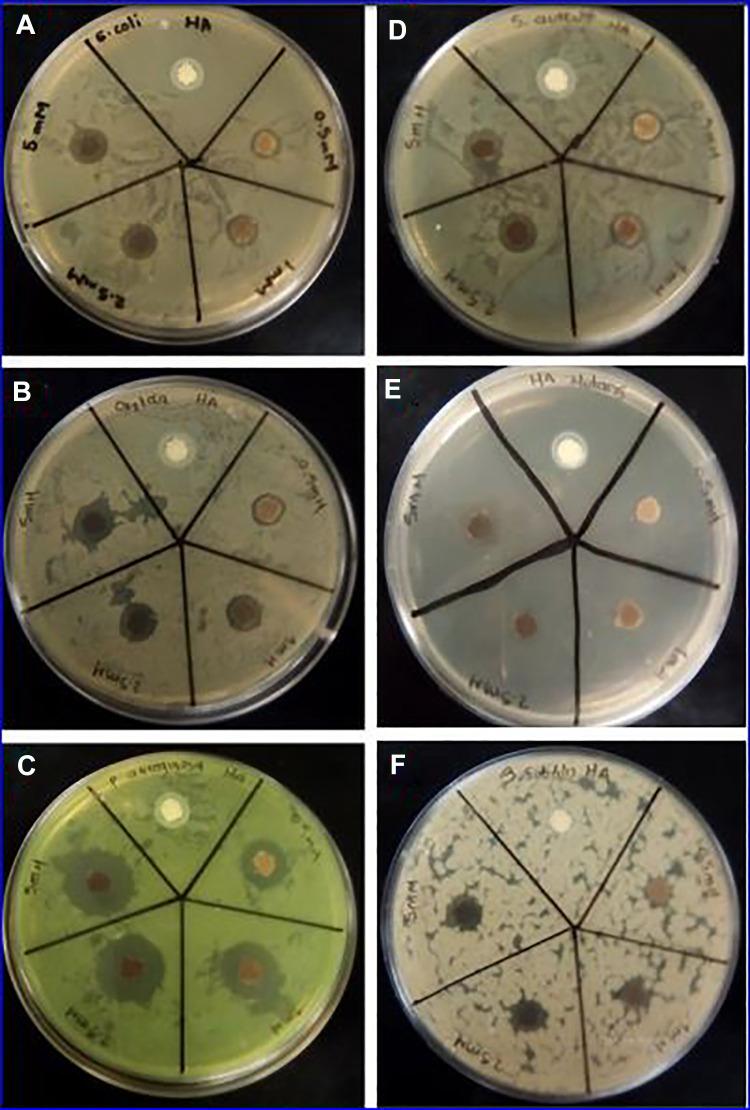 https://cdn.ncbi.nlm.nih.gov/pmc/blobs/0fbe/7485164/8f021d04242a/10.1177_1559325820951342-fig7.jpg