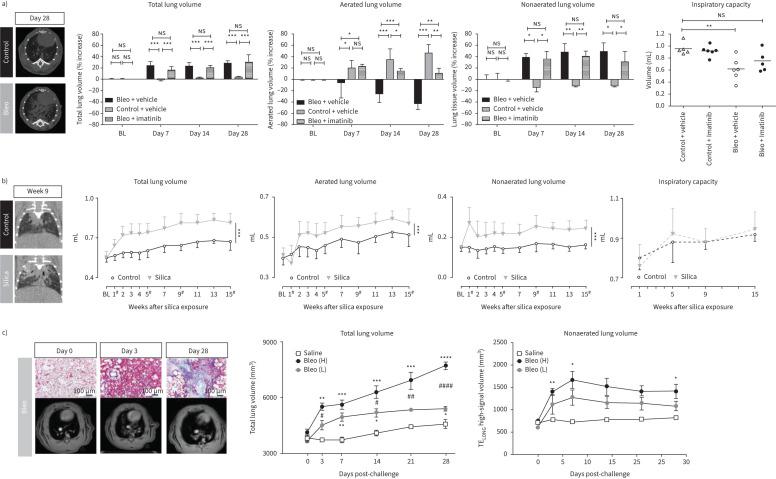 https://cdn.ncbi.nlm.nih.gov/pmc/blobs/0fbf/12406025/5da0115211bc/ERR-0012-2025.02.jpg