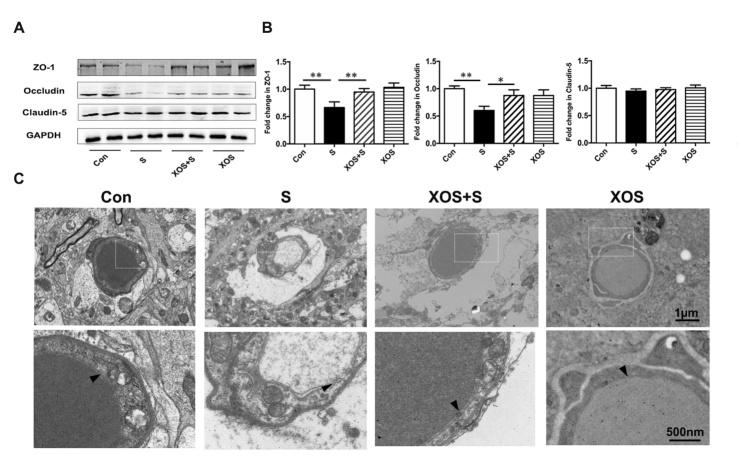 https://cdn.ncbi.nlm.nih.gov/pmc/blobs/0fc0/7505279/74df61a2d739/ad-11-5-1029-g6.jpg