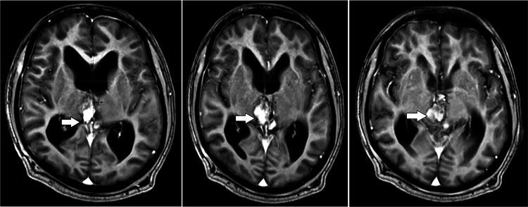 https://cdn.ncbi.nlm.nih.gov/pmc/blobs/0fc4/11992368/058212da0458/gr2.jpg