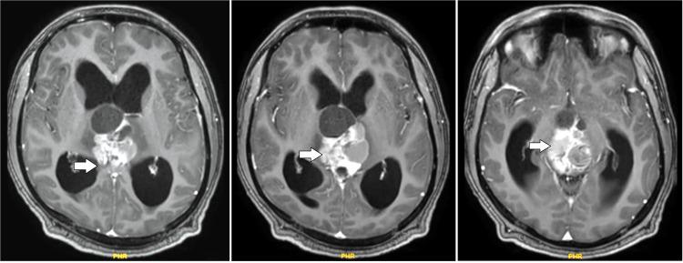 https://cdn.ncbi.nlm.nih.gov/pmc/blobs/0fc4/11992368/3b747a24c8b1/gr1.jpg