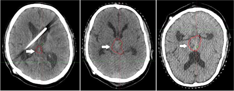 https://cdn.ncbi.nlm.nih.gov/pmc/blobs/0fc4/11992368/adc200fb3275/gr3.jpg