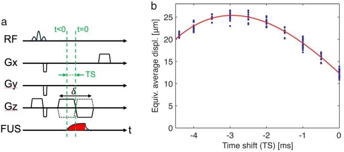 https://cdn.ncbi.nlm.nih.gov/pmc/blobs/0fc5/12179369/2105e4f6b6db/JMRI-62-20-g009.jpg