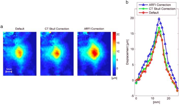https://cdn.ncbi.nlm.nih.gov/pmc/blobs/0fc5/12179369/807023ef0635/JMRI-62-20-g010.jpg