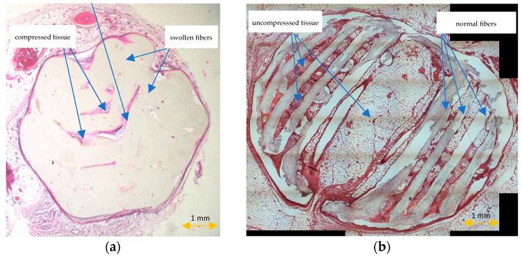 https://cdn.ncbi.nlm.nih.gov/pmc/blobs/0fcf/8911251/f9da7881a6e2/materials-15-01732-g007.jpg