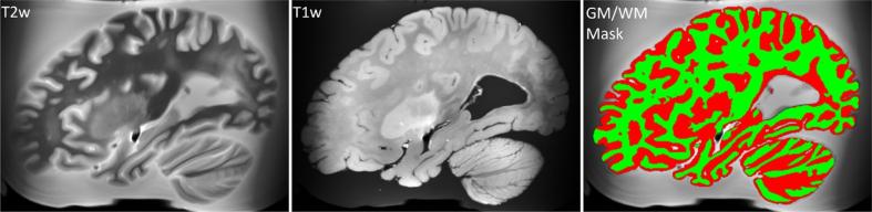 https://cdn.ncbi.nlm.nih.gov/pmc/blobs/0fd4/10741332/0be095e6edc3/jad-96-jad230389-g006.jpg