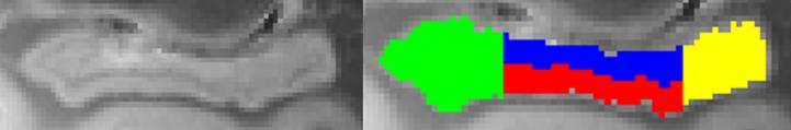https://cdn.ncbi.nlm.nih.gov/pmc/blobs/0fd4/10741332/12d4350ff7fb/jad-96-jad230389-g008.jpg