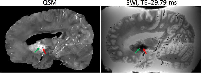https://cdn.ncbi.nlm.nih.gov/pmc/blobs/0fd4/10741332/e2c957530f31/jad-96-jad230389-g004.jpg