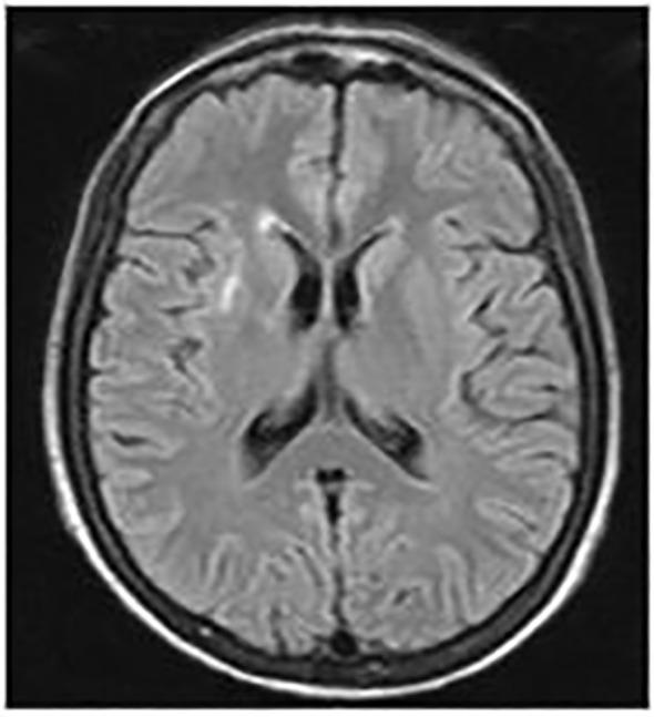 https://cdn.ncbi.nlm.nih.gov/pmc/blobs/0fd4/11649502/d65540855774/fimmu-15-1454813-g001.jpg