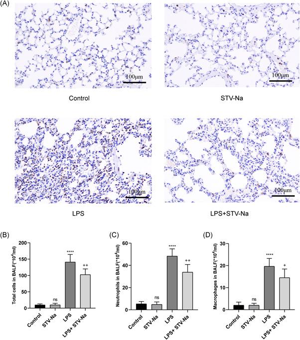https://cdn.ncbi.nlm.nih.gov/pmc/blobs/0fd5/9846117/18ef3fbd2e7c/IID3-11-e770-g001.jpg
