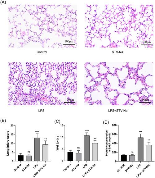 https://cdn.ncbi.nlm.nih.gov/pmc/blobs/0fd5/9846117/6d05c17de76e/IID3-11-e770-g004.jpg