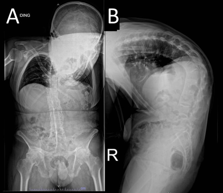 https://cdn.ncbi.nlm.nih.gov/pmc/blobs/0fdd/11500485/6d6f2dc7f6c5/cureus-0016-00000070091-i02.jpg