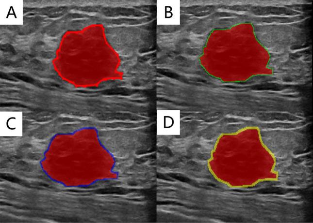https://cdn.ncbi.nlm.nih.gov/pmc/blobs/0fe7/12141173/6a1f8b7e6fb9/12672_2025_2752_Fig2_HTML.jpg