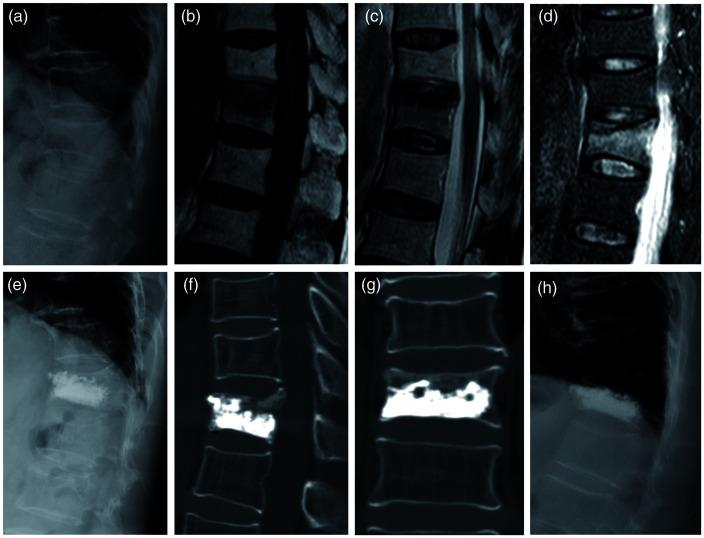 https://cdn.ncbi.nlm.nih.gov/pmc/blobs/0fe8/8755653/9e5c88f1a6a2/10.1177_03000605211022287-fig1.jpg