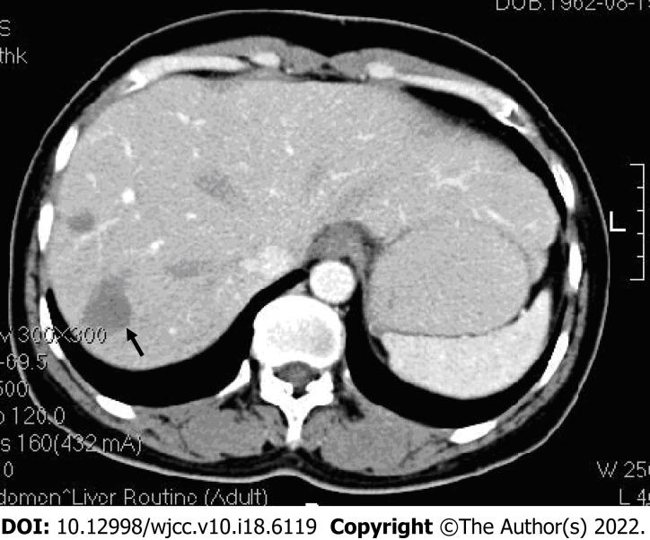 https://cdn.ncbi.nlm.nih.gov/pmc/blobs/0ff5/9254202/68a16d8c4133/WJCC-10-6119-g001.jpg