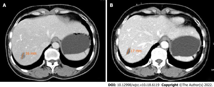 https://cdn.ncbi.nlm.nih.gov/pmc/blobs/0ff5/9254202/93f69c2060c7/WJCC-10-6119-g005.jpg