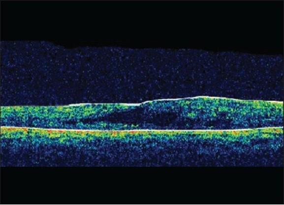 https://cdn.ncbi.nlm.nih.gov/pmc/blobs/0ff8/2841382/ad7477c73730/IJO-58-76-g002.jpg