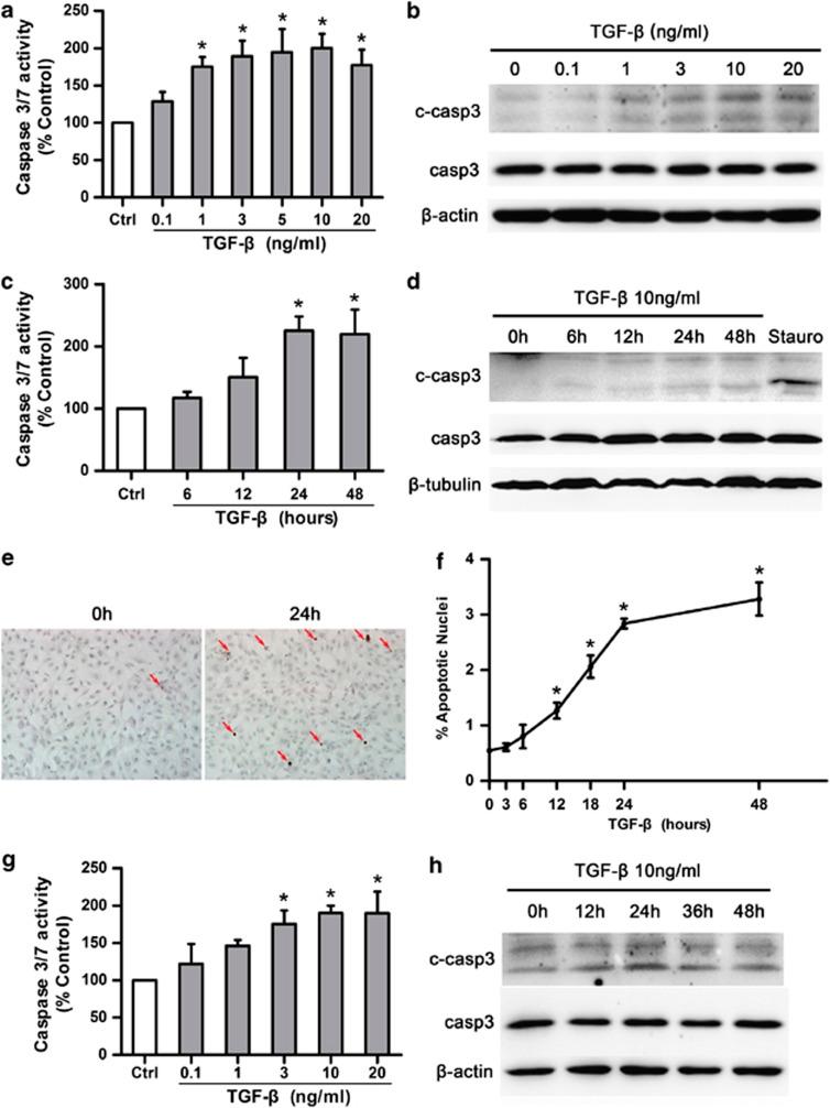 https://cdn.ncbi.nlm.nih.gov/pmc/blobs/0ffd/4040700/2355468ca235/cddis2013551f1.jpg