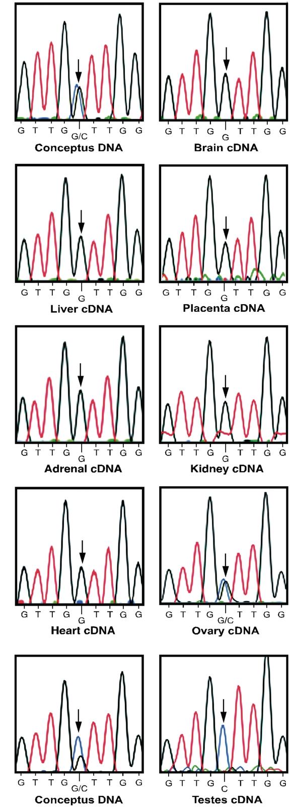 https://cdn.ncbi.nlm.nih.gov/pmc/blobs/1006/3141237/10190fd0d0e9/gkr108f4.jpg