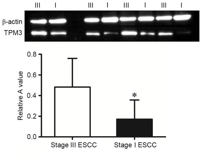 https://cdn.ncbi.nlm.nih.gov/pmc/blobs/1006/5367371/9bfbcae1d8d8/MMR-15-03-1236-g02.jpg