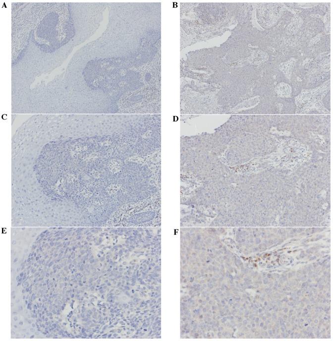 https://cdn.ncbi.nlm.nih.gov/pmc/blobs/1006/5367371/9eb6b4acaf9d/MMR-15-03-1236-g03.jpg