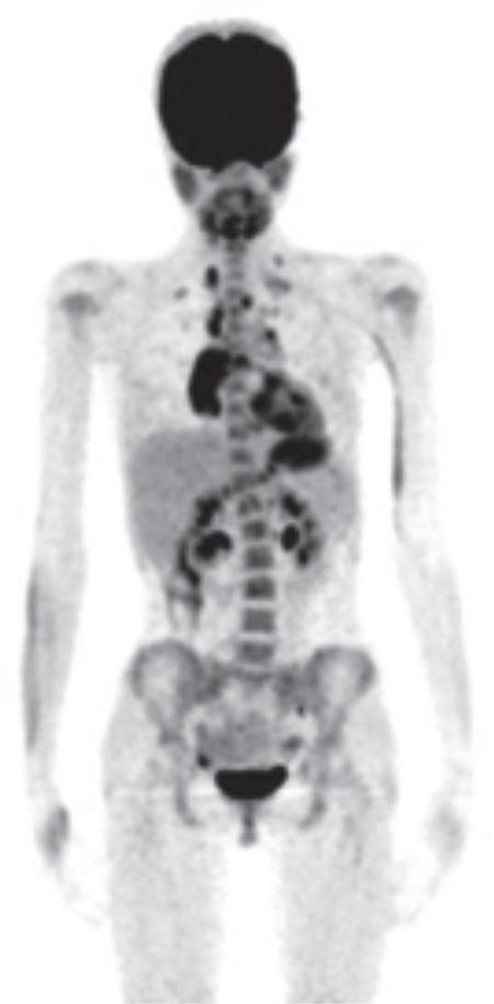 https://cdn.ncbi.nlm.nih.gov/pmc/blobs/1007/5350506/a24ba2245b32/MIRT-26-9-g3.jpg